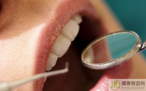 如何美白牙齒 如何美白牙齒