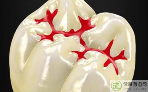 齲齒是什麼 齲齒是什麼