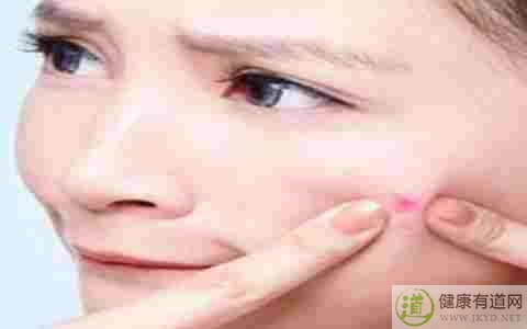 紅腫痘痘怎麼辦 紅腫痘痘怎麼辦