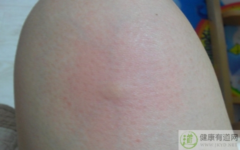 夏季如何防蚊蟲