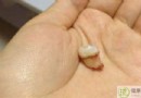 冬天上火牙疼怎麼辦？4個快速緩解方法與日常護牙全攻略